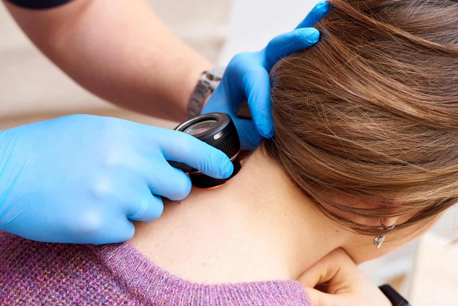Hautkrebsvorsorge mit einem Dermatoskop